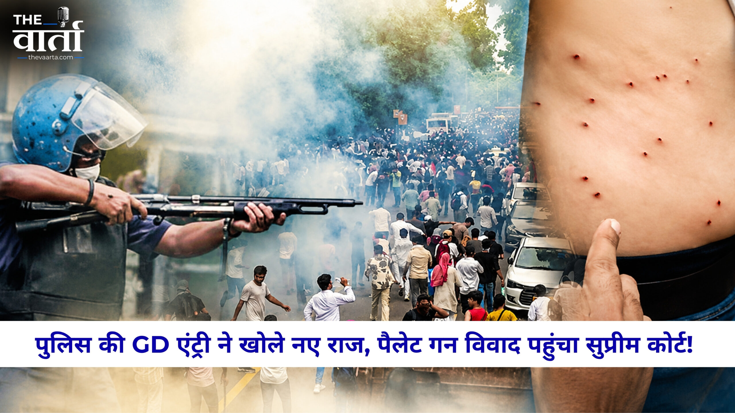 CJP Protest: पैलेट गन विवाद पहुंचा सुप्रीम कोर्ट, पुलिस की जनरल डायरी की एंट्री से जांच को मिली नई दिशा
