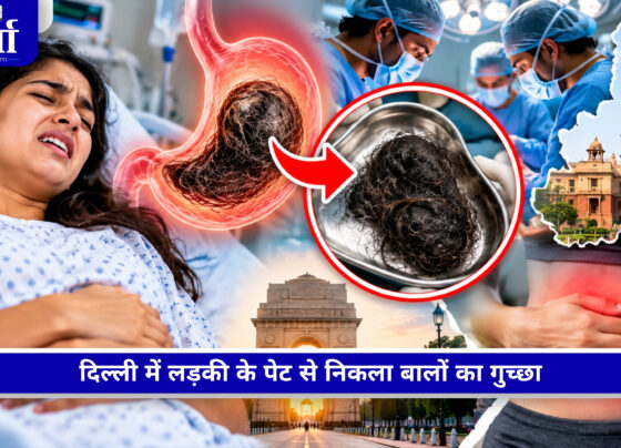 दिल्ली में 20 साल की लड़की के पेट से निकाला गया 1.16 किलो का बालों का गुच्छा
